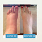 Masajeador de Pies para Dolor & Hinchazón/Foot massager for pain and swelling relief