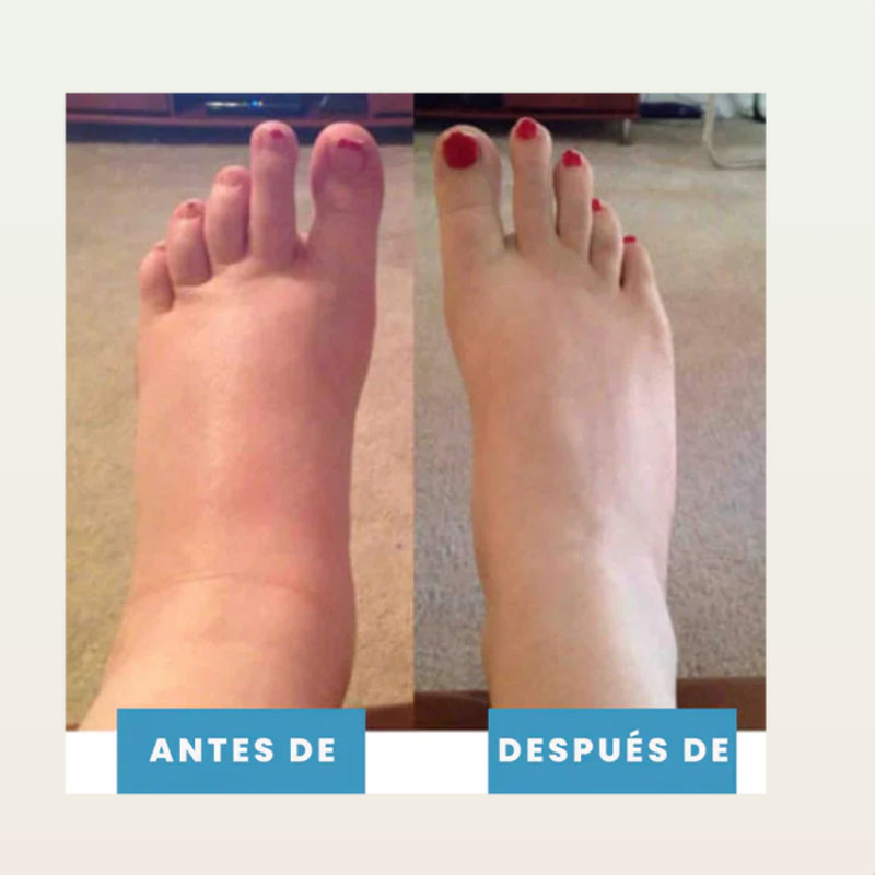 Masajeador de Pies para Dolor & Hinchazón/Foot massager for pain and swelling relief