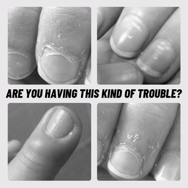 Crocodile Bionic Nail Clippers