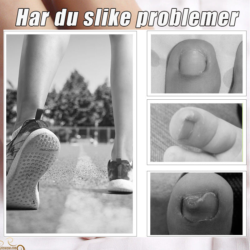 Negleklippersett I Rustfritt Stål/Stainless Steel Eagle Mouth Pliers