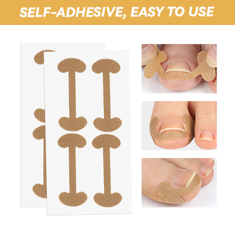 Nail Groove Ingrown Toenail Patch
