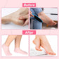 Exfoliating Silicone Beach Socks-Rejuvenate your feet! 👣💕