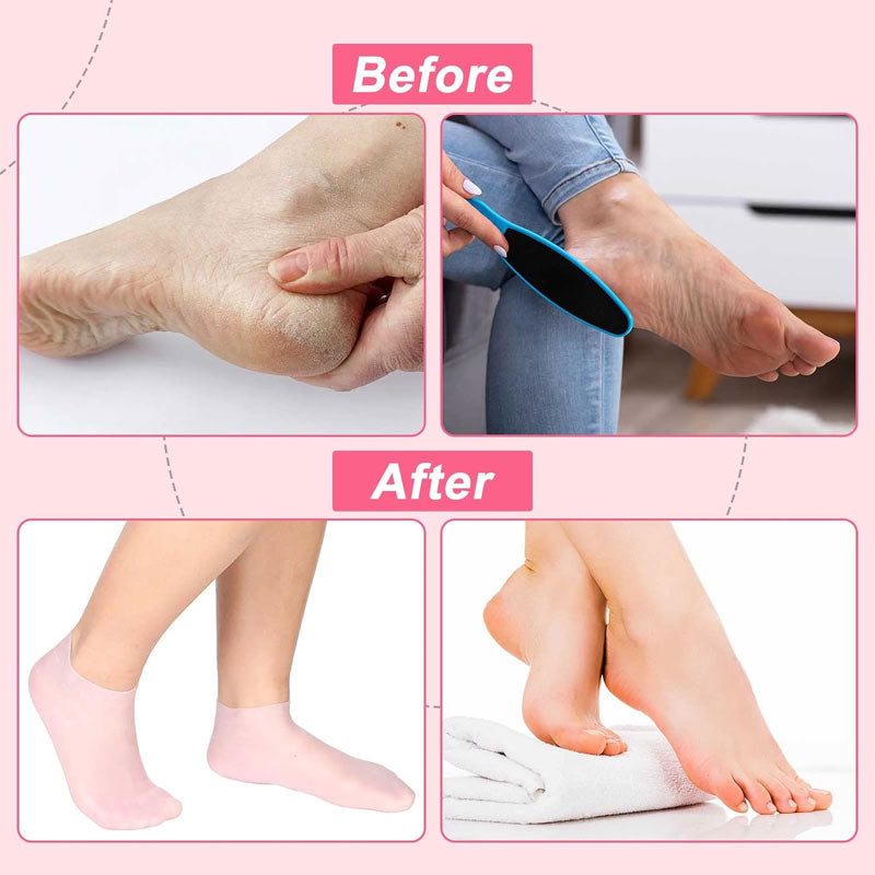 Exfoliating Silicone Beach Socks-Rejuvenate your feet! 👣💕
