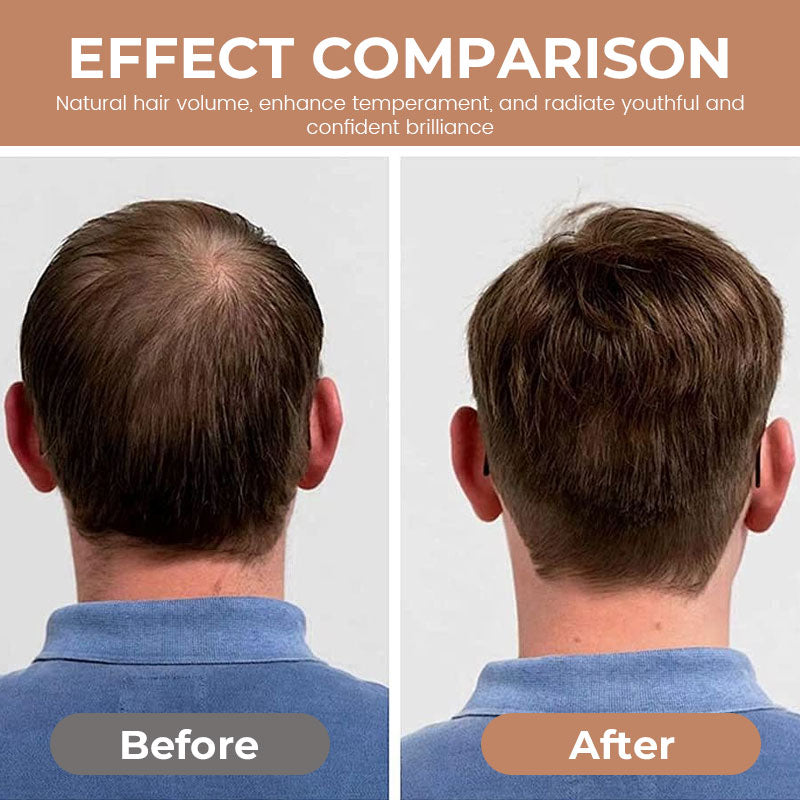 Men's Handsome Invisible Wig