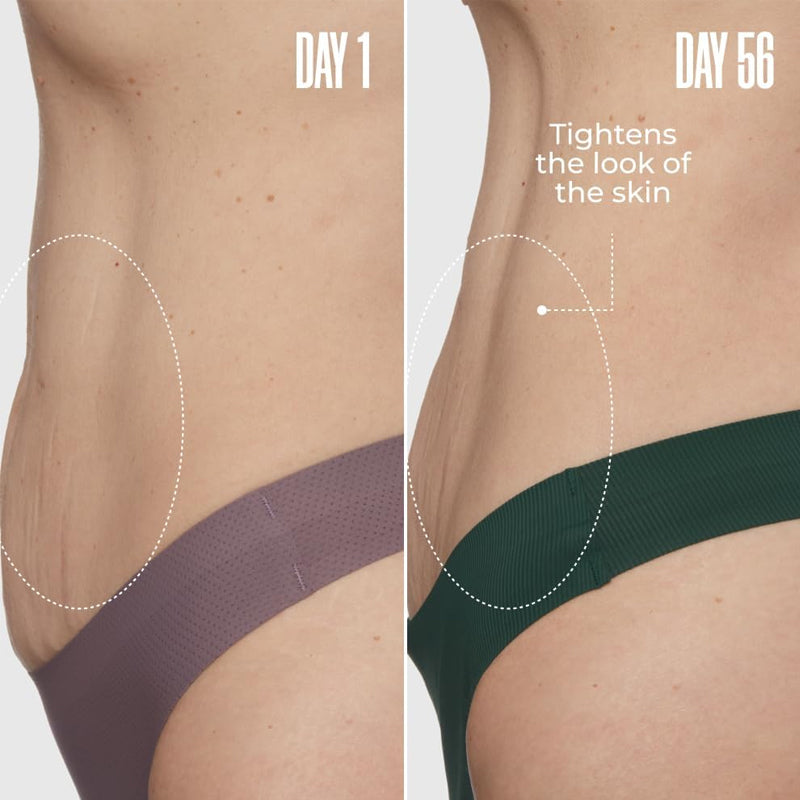 Postpartum Belly Repair Cream