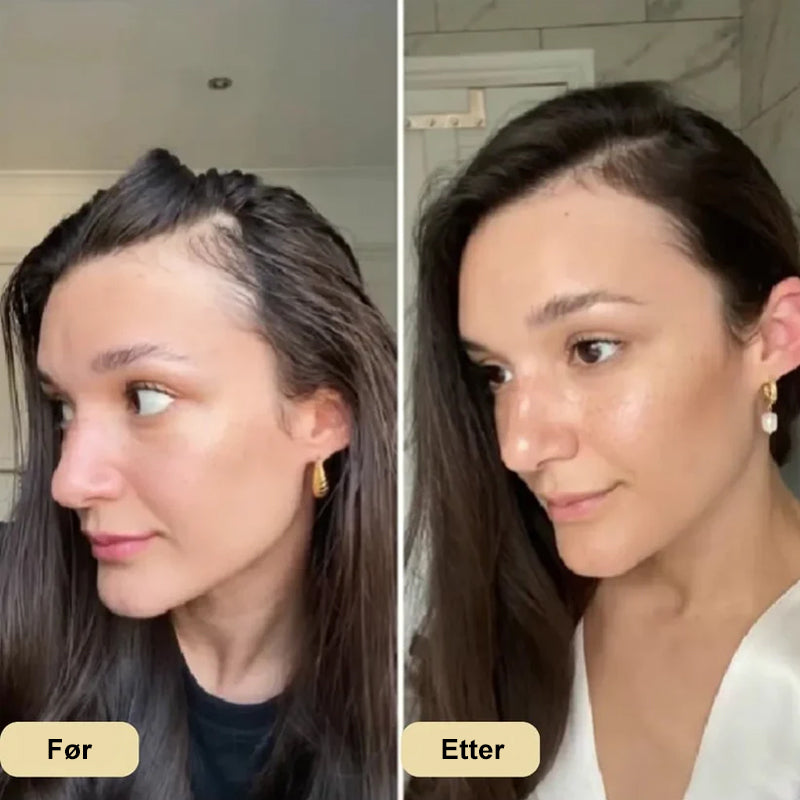 ✨Naturlig hårvekstolje/natural hair growth oil