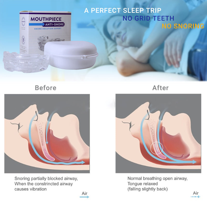 Adjustable Nighttime Teeth Grinding Tray