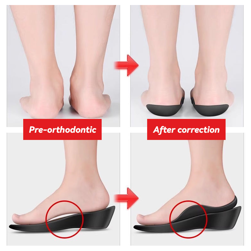 Leg Corrective Insoles
