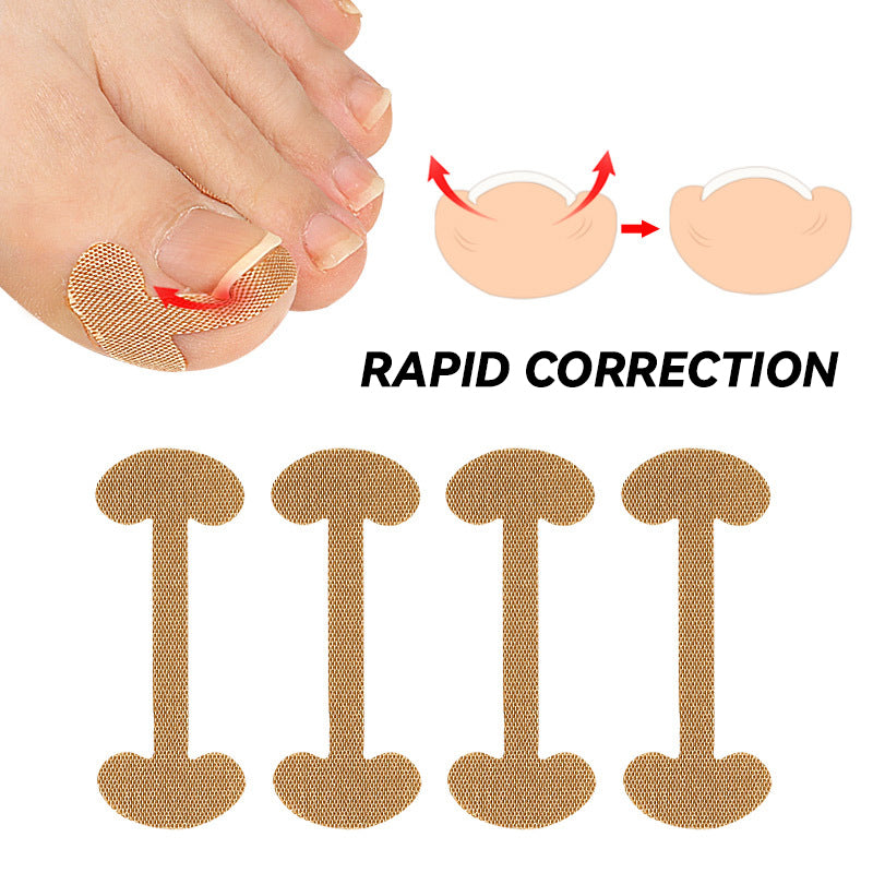 Nail Groove Ingrown Toenail Patch