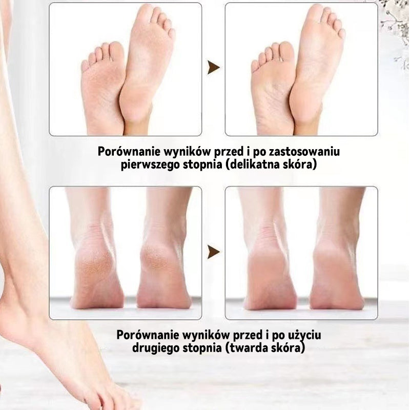 Podświetlana Elektryczna Szlifierka Do Stóp/Electric foot grinder