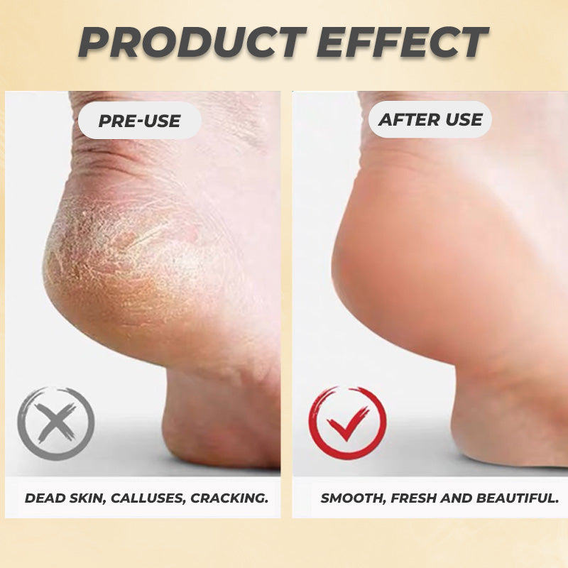 Stainless Steel Foot File