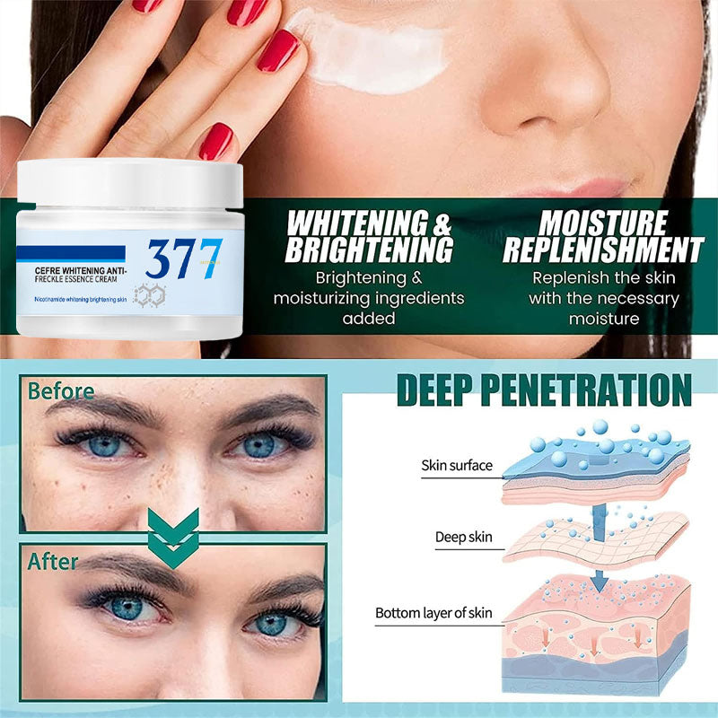 Whitening Freckle Cream