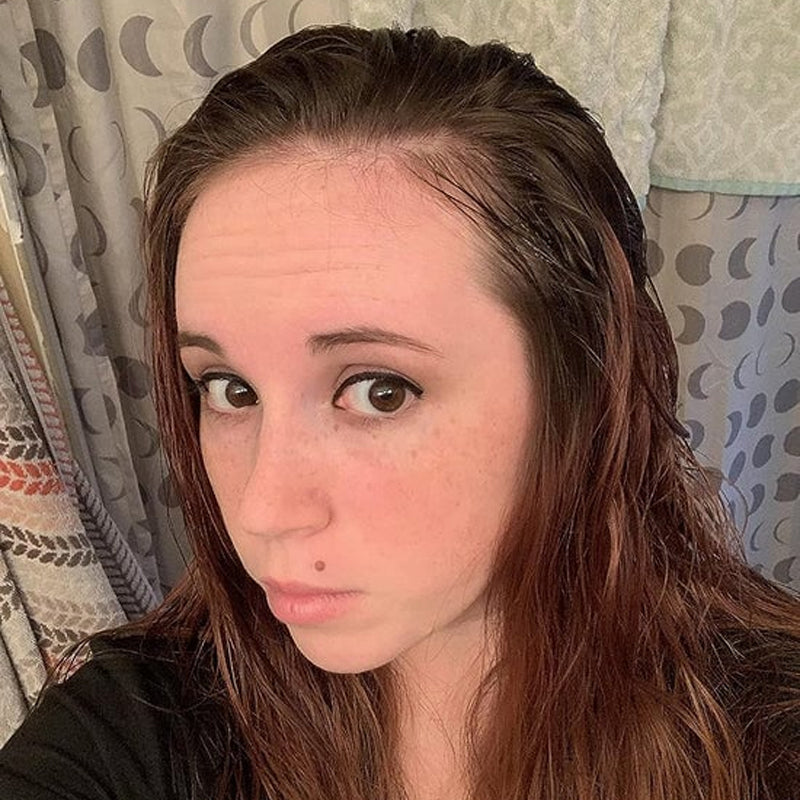 ✨Naturlig hårvekstolje/natural hair growth oil