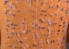 Portable Lint Remover Fuzz Shaver