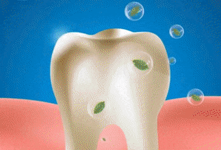 Intensive Stain Removal Whitening Toothpaste