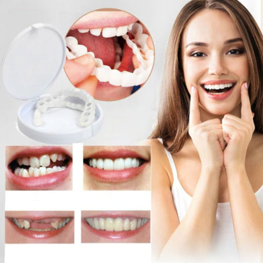 Snap on Smile Veneers