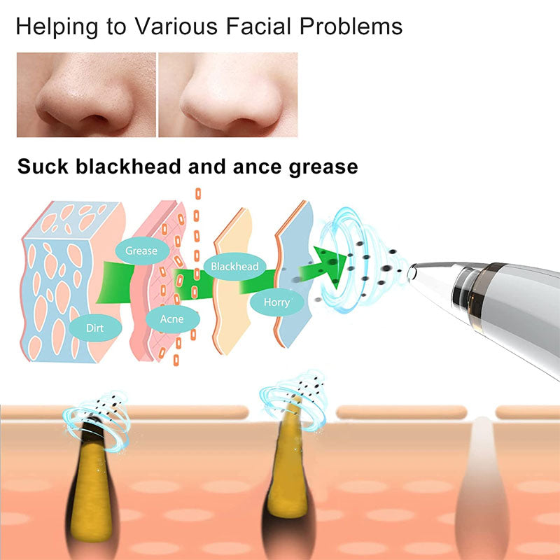 Blackhead Remover Vacuum
