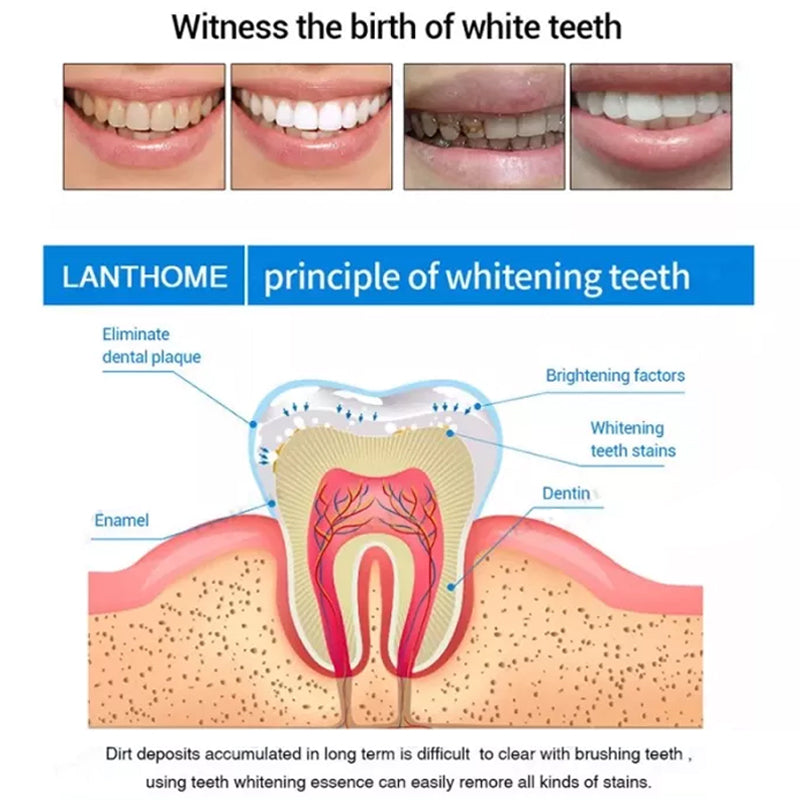 Teeth Whitening Pens
