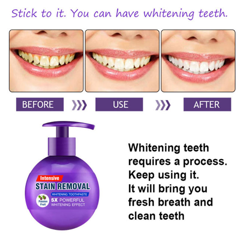 Intensive Stain Removal Whitening Toothpaste
