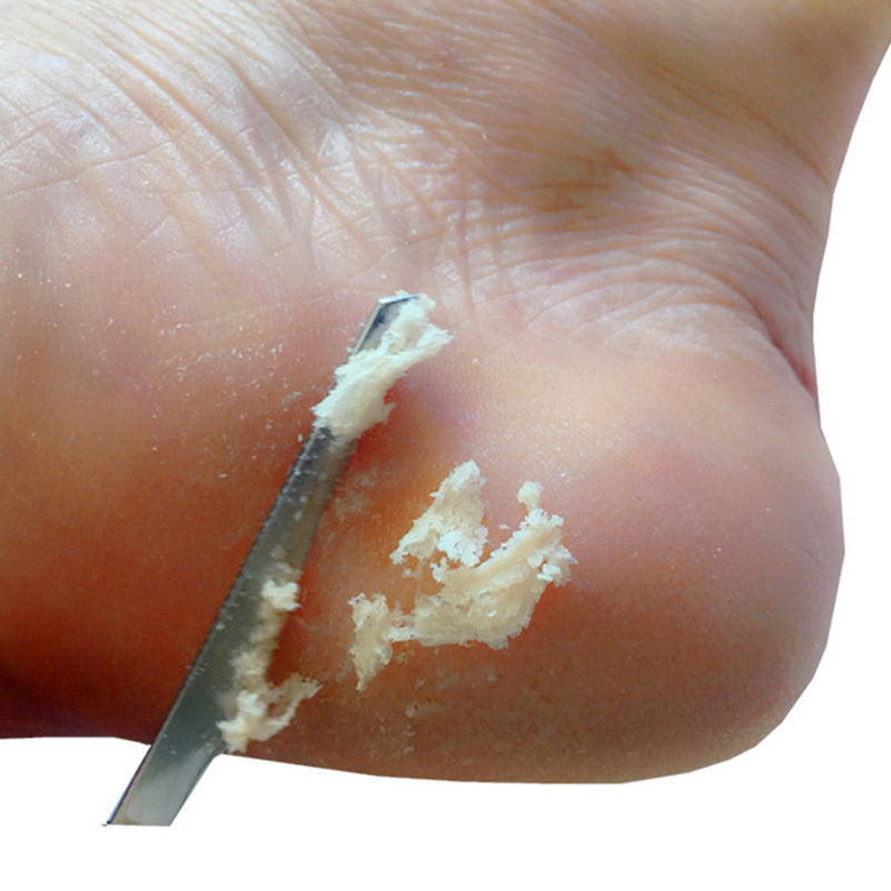 Stainless Steel Foot Scraper Knife to Remove Dead Skin Callus