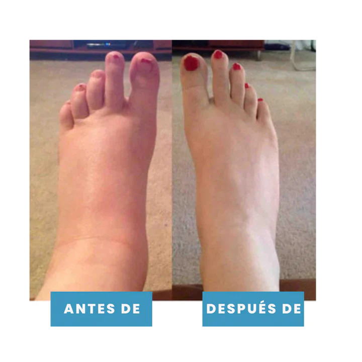 Masajeador de Pies para Dolor & Hinchazón/Foot massager for pain and swelling relief