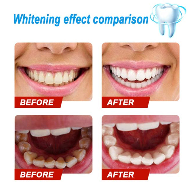 Intensive Stain Removal Whitening Toothpaste