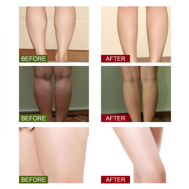 Wormwood Foot Bath Bag