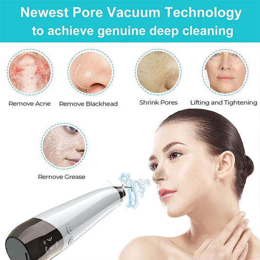 Blackhead Remover Vacuum