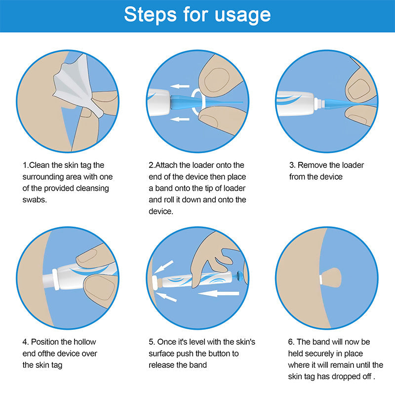 Skin Tag Removal Kit