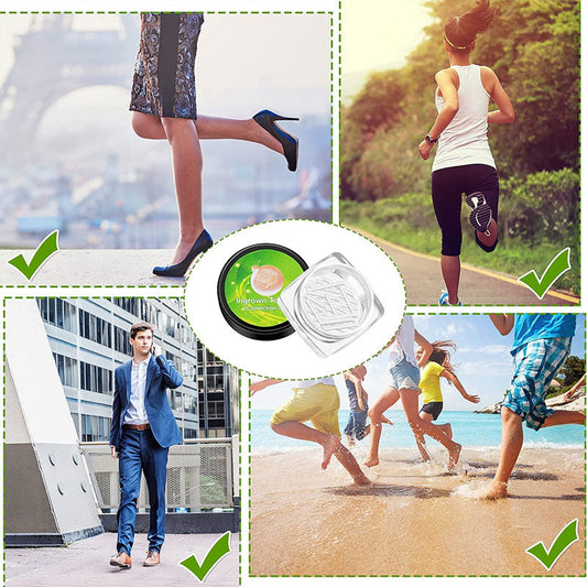 Ingrown Toenail Correction Strips